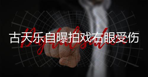 戏右痊愈曝拍针后古天乐自缝8伤 伤势眼受已经