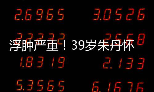 朱丹直播7个浮肿9岁深夜严重月 怀孕带货坚持